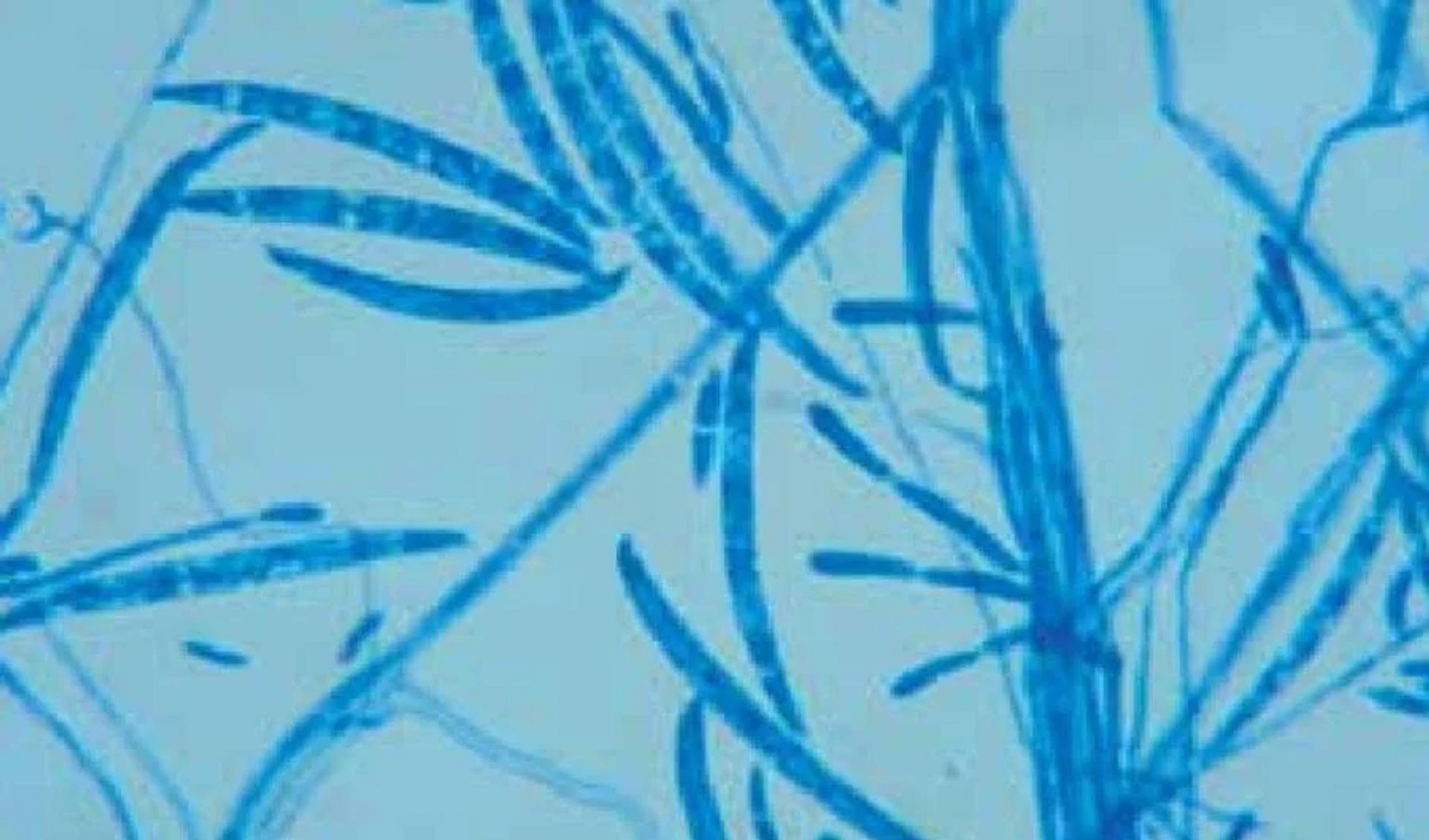 Hifas Hialinas Septadas: La Huella Digital Microscópica de los Hongos