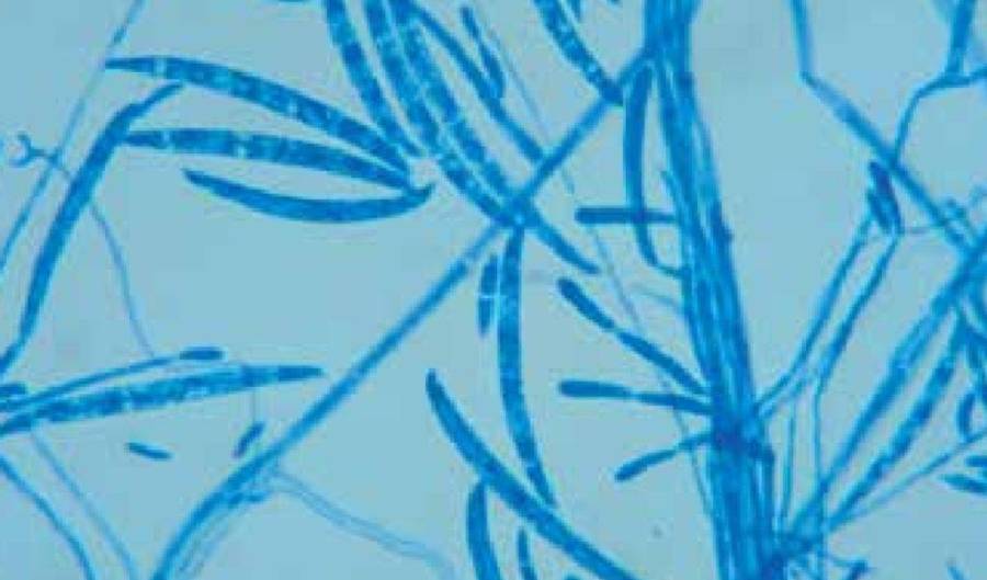 Entiende las hifas septadas: estructuras compartimentadas que dan a los hongos modernos (como los champi?ones) resistencia y capacidad de regeneraci?n.