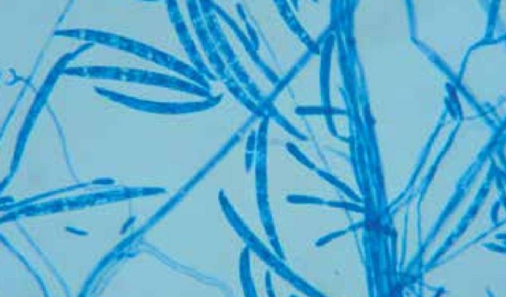 Explorando el Mundo Microsc¿Pico: Una Mirada Profunda a las Hifas Septadas