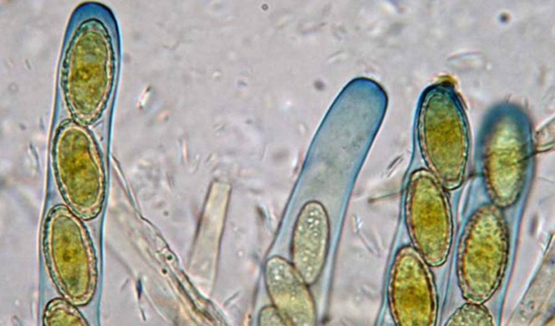 Exosporas: Las Esporas Externas de Bacterias y Actinomicetos