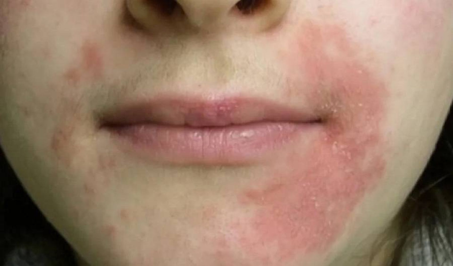 Conidiosporas: Por Qu¡ Ese Moho en Tu Pared Crece Tan Rápido