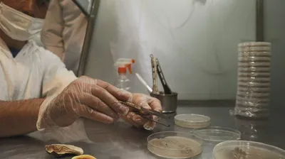 Hongos Imperfectos Explicados: Una Guía Completa sobre Deuteromicetos