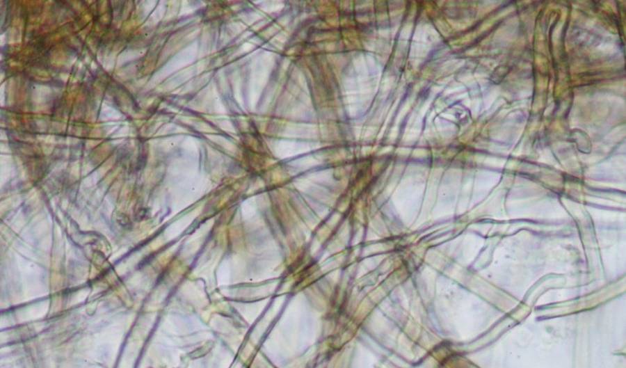 Hifas: Los Cables de Fibra Óptica del Reino Fungi
