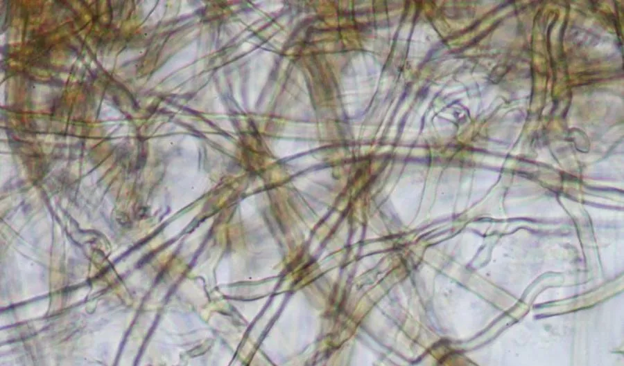 Si el micelio es la red, las hifas son los cables. Descubre la anatomía microscópica de los hongos: crecimiento apical, transporte de nutrientes y la diferencia entre hifas septadas y cenocíticas.
