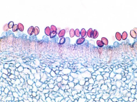 Microsporidia: Un Enemigo Silencioso en el Reino Fungi