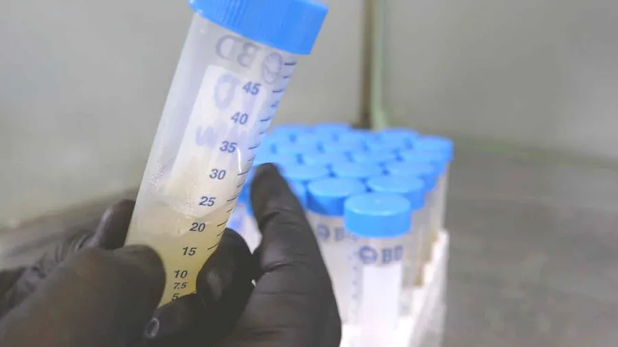 Antibi¡tico con Agar: Preparación y Uso en Medios de Cultivo