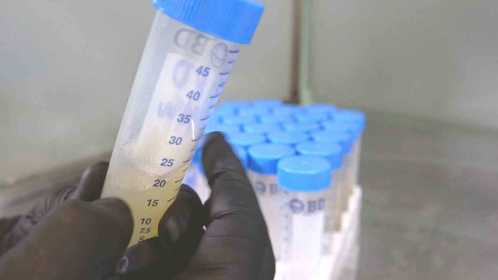 Antibi¡tico con Agar: Preparación y Uso en Medios de Cultivo