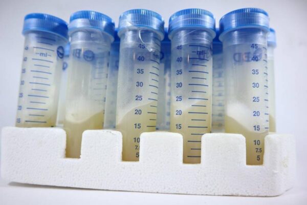 Pleurotus Eryngii / Cepa de eryngii