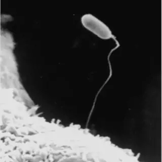 Microsporidia: Un Enemigo Silencioso en el Reino Fungi 1 Microsporidia